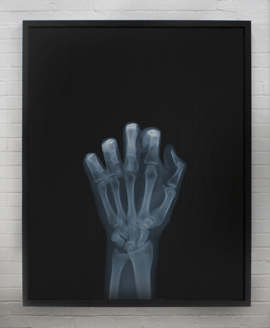 Framed Lenticular black and white x-ray photograph by Nick Veasey of a skeletal hand flipping the bird to the camera, middle finger is moving up and down 